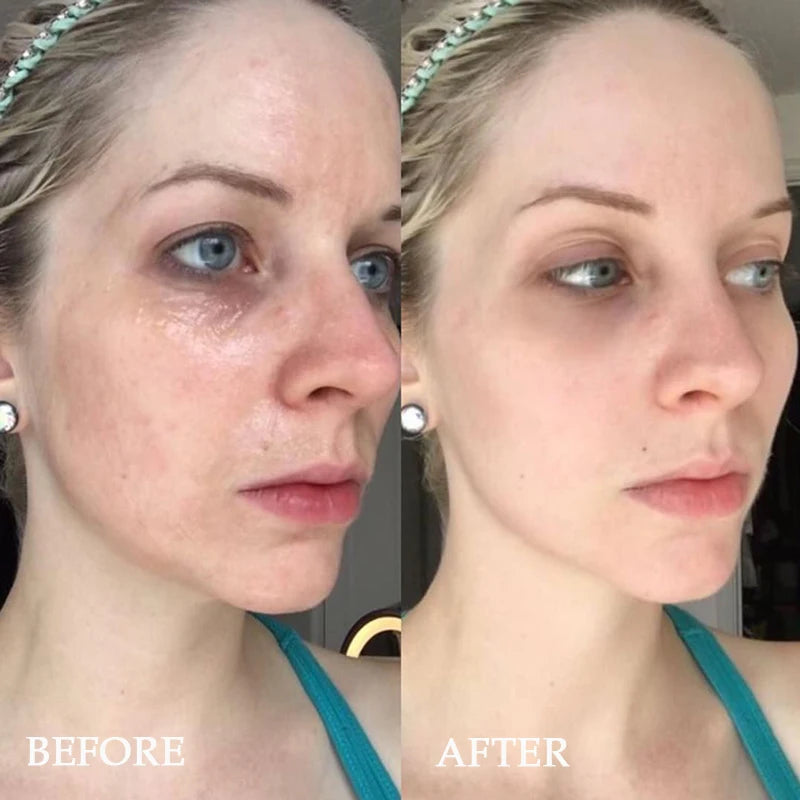 Anti-Aging Peptide & Hyaluronic Repair Vial Set (10-Vial Firming Treatment Kit)